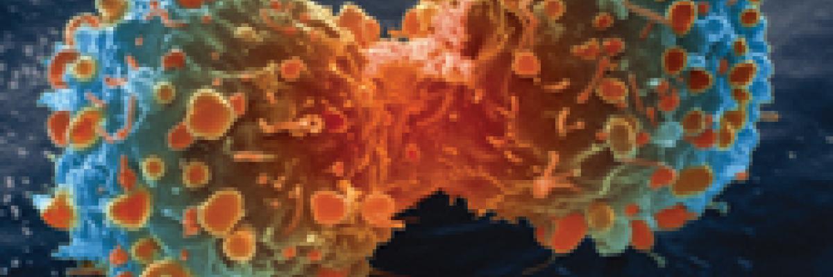 Lung cancer cell during cell division